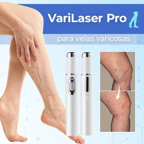 LASER PORTATIL ELIMINA VARICES ARRUGAS ACNES