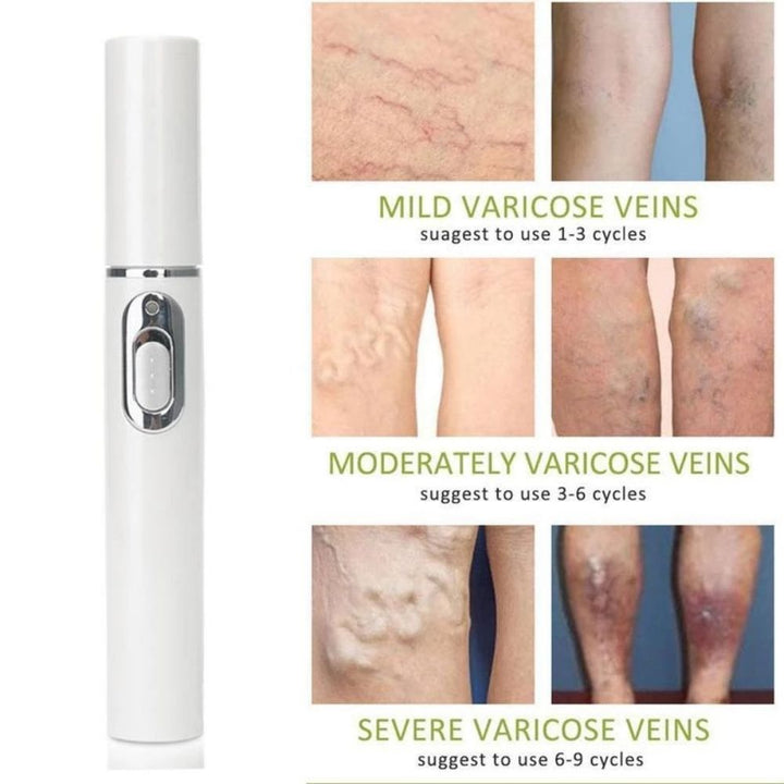 LASER PORTATIL ELIMINA VARICES ARRUGAS ACNES